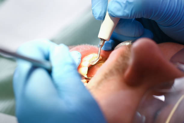 Best Teeth Whitening  in Gaylord, MI
