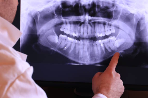 Urgent Tooth Repair in MI